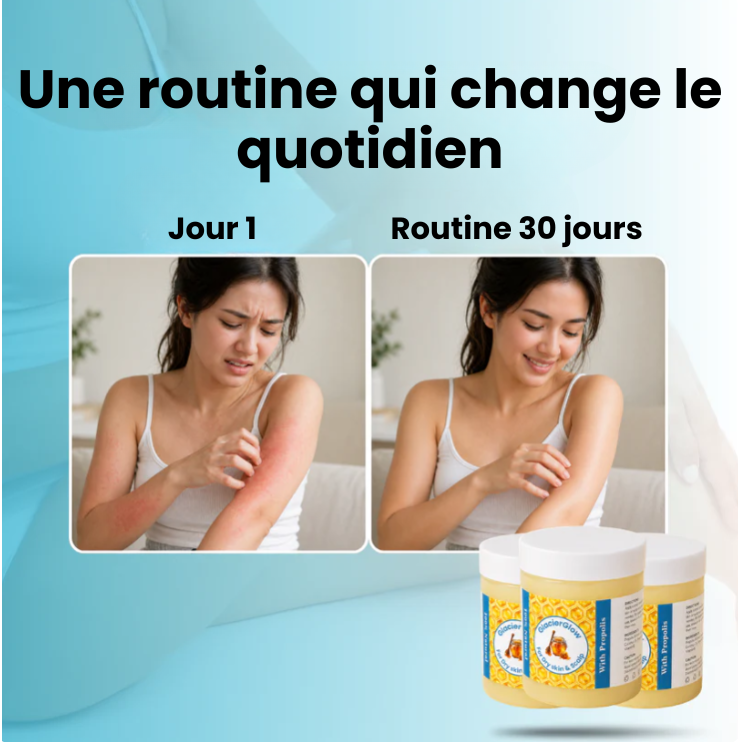 GlacierGlow Skin - Baume nourrissant pour peaux sèches et sensibles