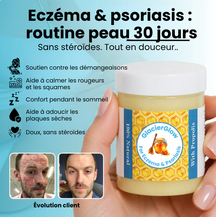 GlacierGlow Skin - Baume nourrissant pour peaux sèches et sensibles